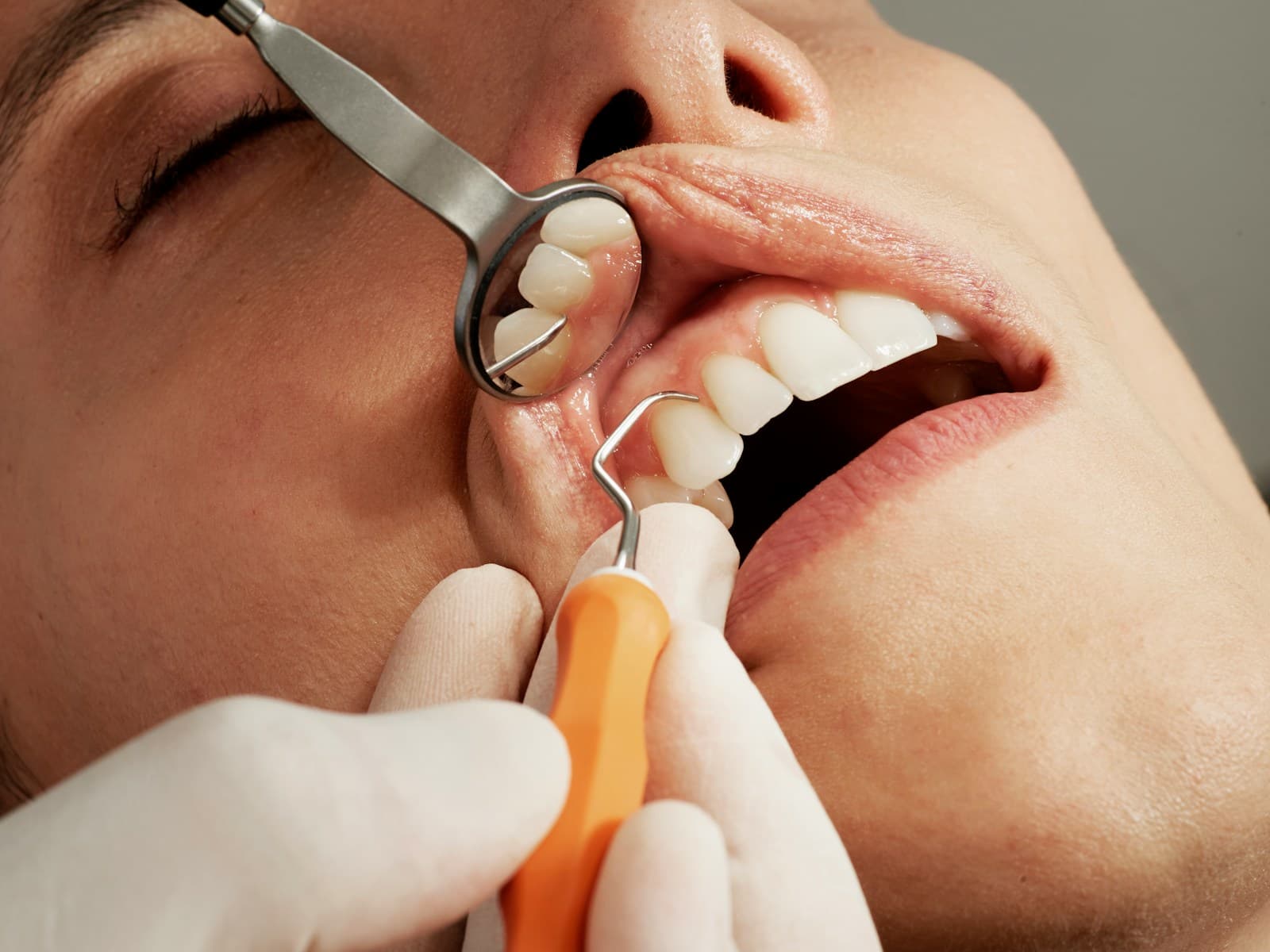 A dentist checking a patient's teeth and gums with a dental mirror and instrument