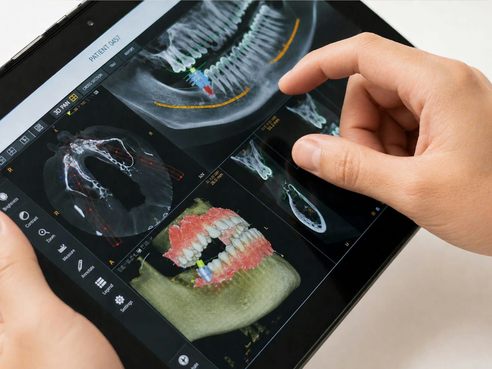 Hands reviewing a 3D digital scan of teeth on a tablet