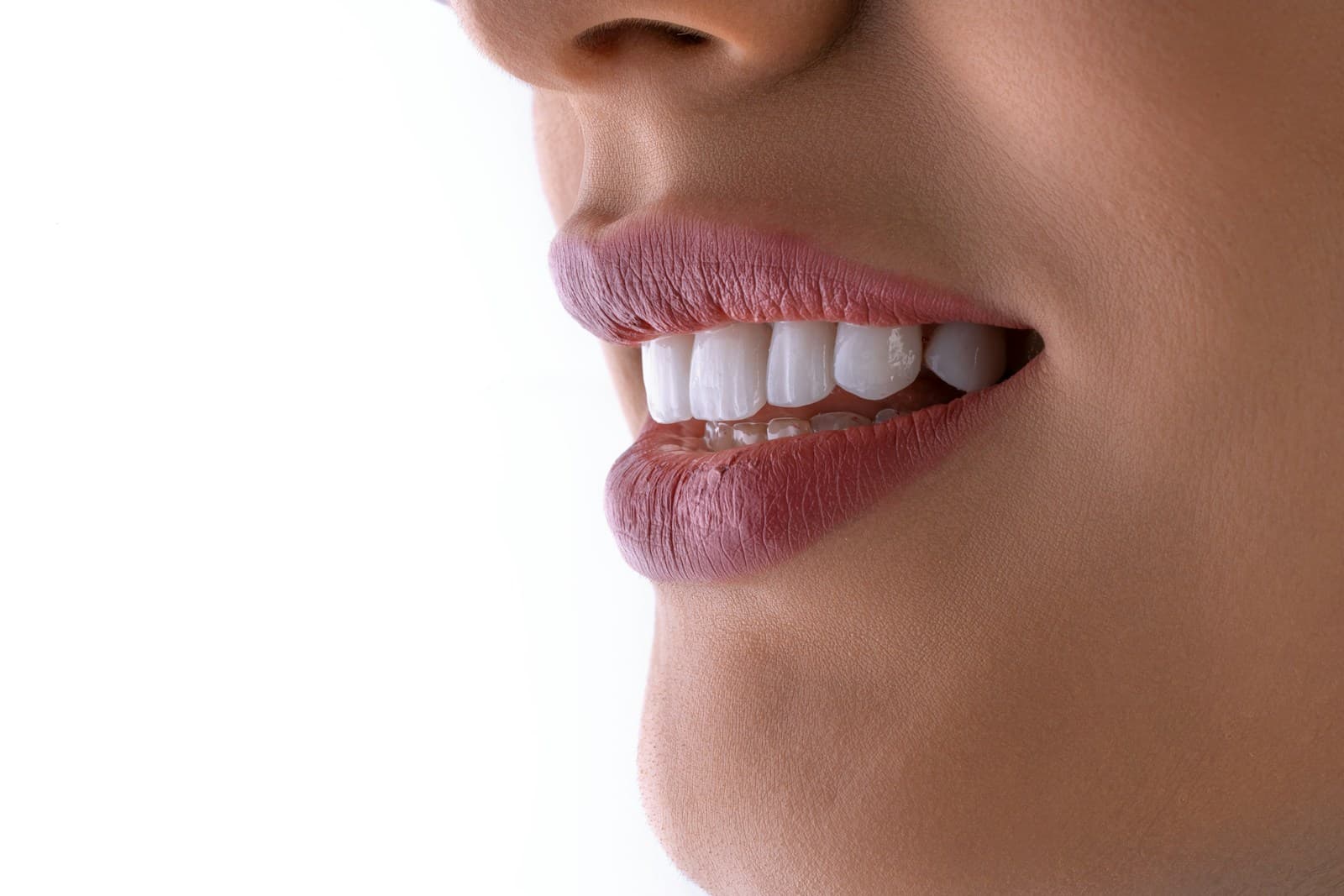 Close-up of a woman's smile showing white teeth