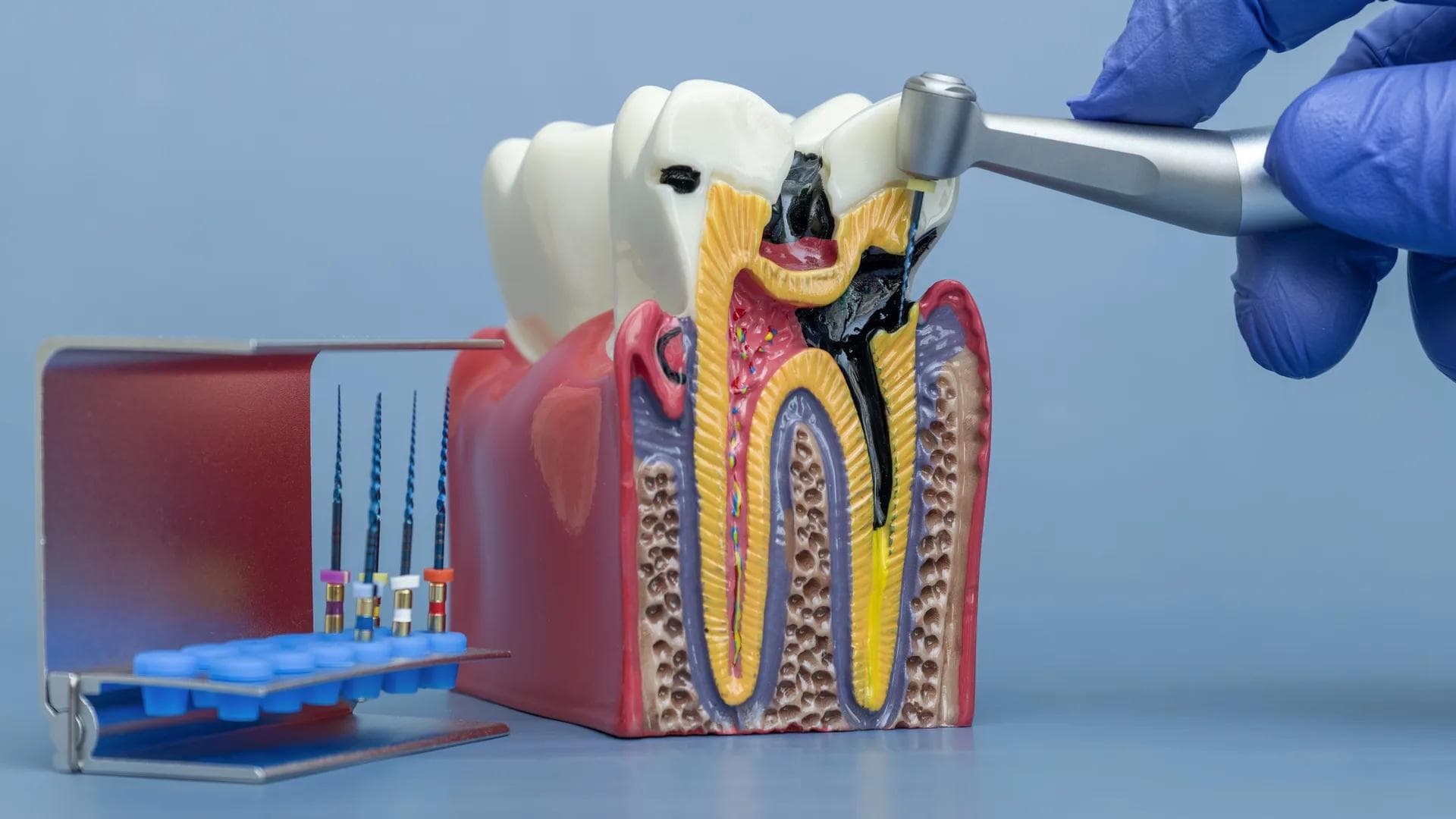 Endodontics