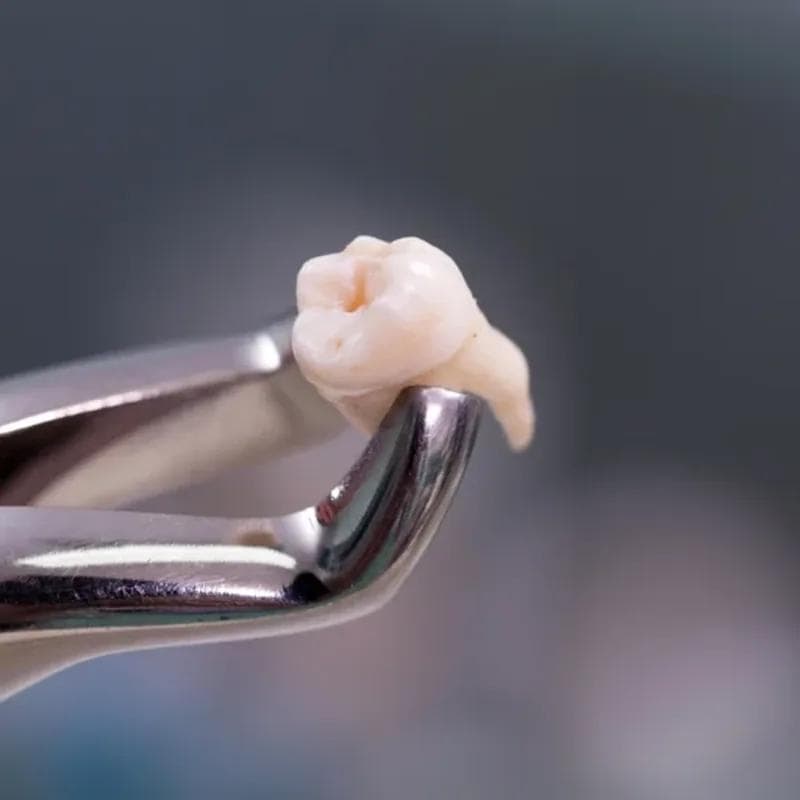 Oral Surgery