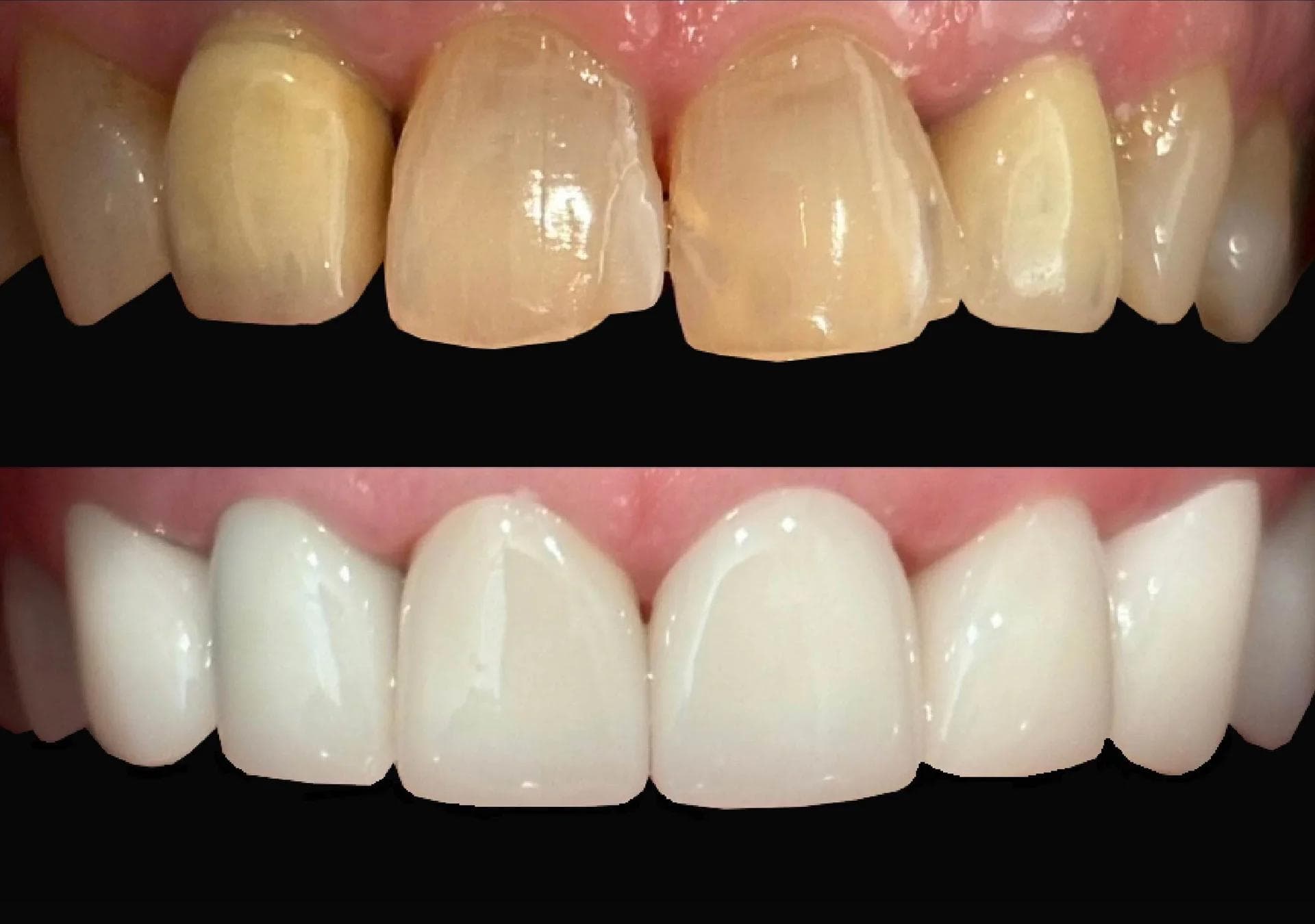Cosmetic Dentistry